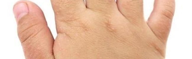 El ungüento para las manos a atopicheskom la dermatitis