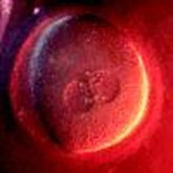 Identifican un gen clave en la formación de óvulos y espermatozoides
