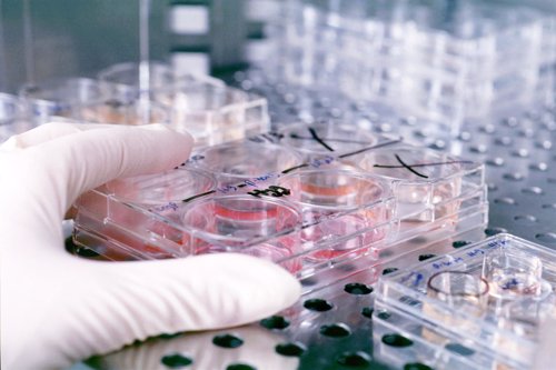 Sylentis iniciará un ensayo clínico con un fármaco para la hipertensión ocular