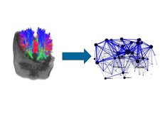 Construcción De Red Para Analizar Daño Cerebral