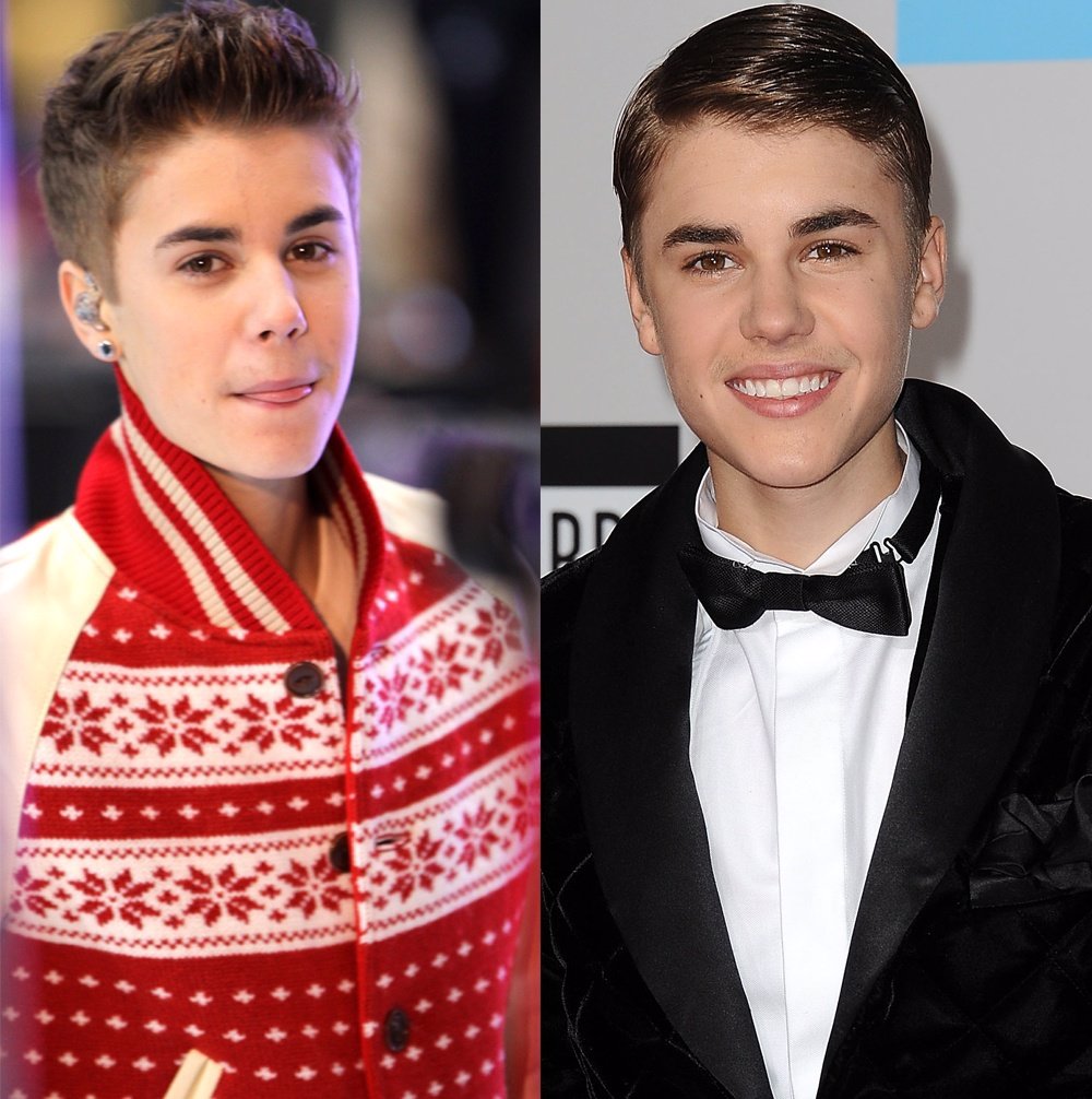 Montaje De Justin Bieber Con Dos Tipos De Peinado 