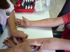 Prueba En El Servicio De Alergología