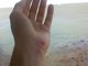 Imagen de la mano de Shakira