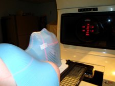 Máscara Termoplástica Para La Irradiación De Un Cáncer De Faringe