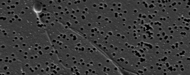 Foto: Descubren un gen clave en la producción de esperma que abre la vía a un anticonceptivo masculino (WIKIMEDIA)