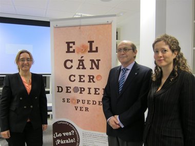 Foto: Una de cada seis personas padecerá al tipo de cáncer cutáneo (EUROPA PRESS)