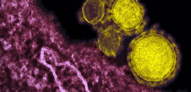 Foto: El nuevo coronavirus no causará una epidemia como el SARS, porque no se propaga tan fácilmente (FLICKER/AJC1)