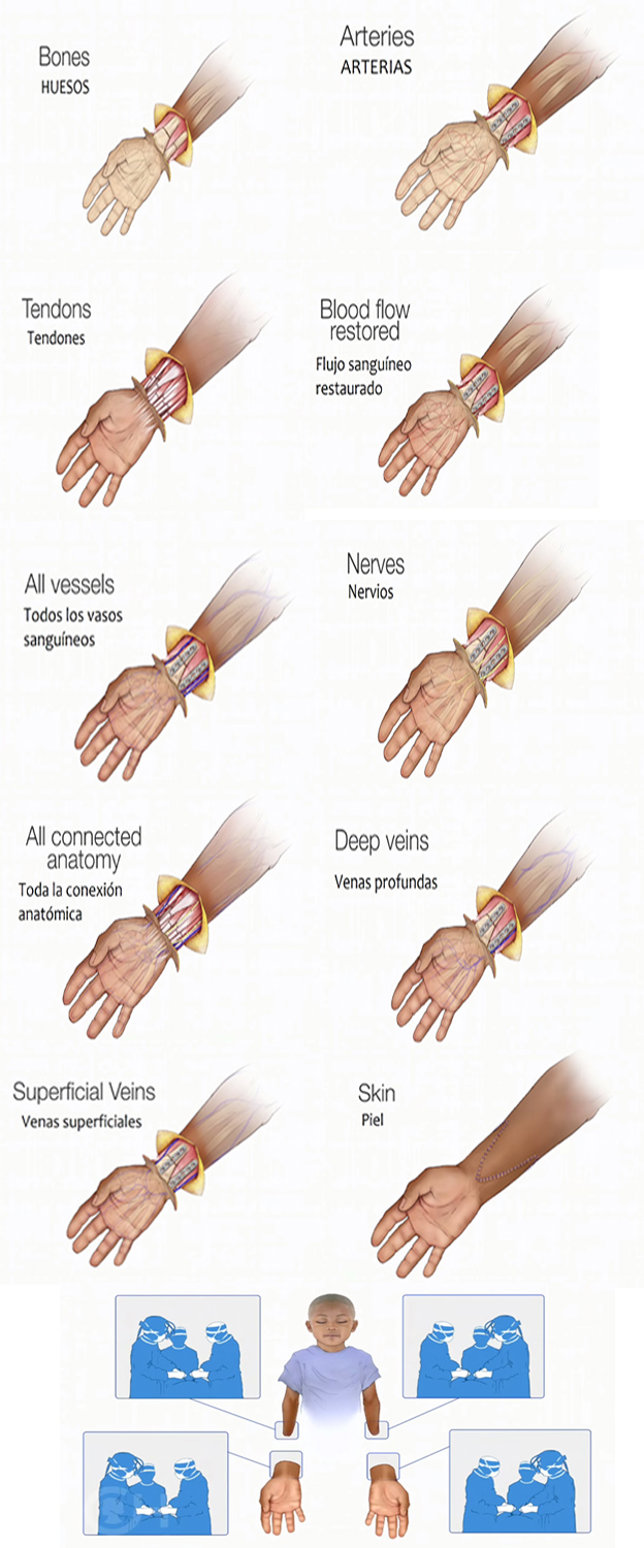 zion surgery montaje