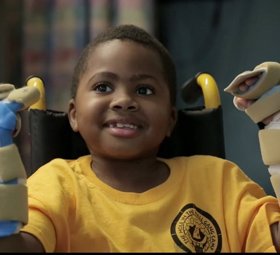 Foto: Zion Harvey, el primer niño del mundo que recibe un transplante de manos (YOUTUBE/CHOP)