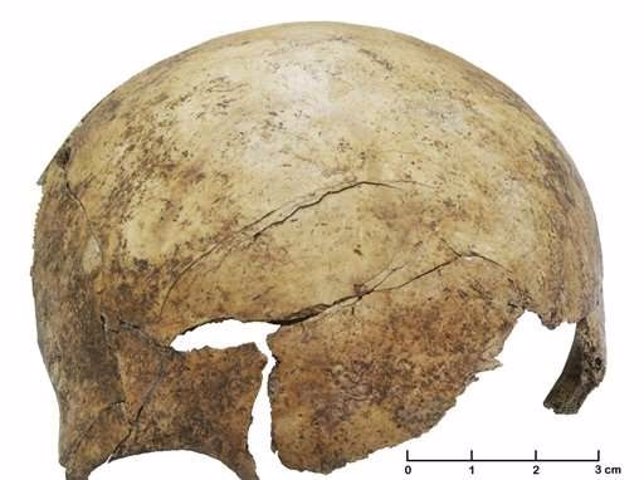 Cráneo con fuerte lesión descubierto en la fosa común
