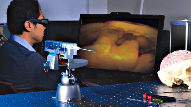 Llega MARVEL, una cámara 3D tan pequeña que permite operar en el cerebro