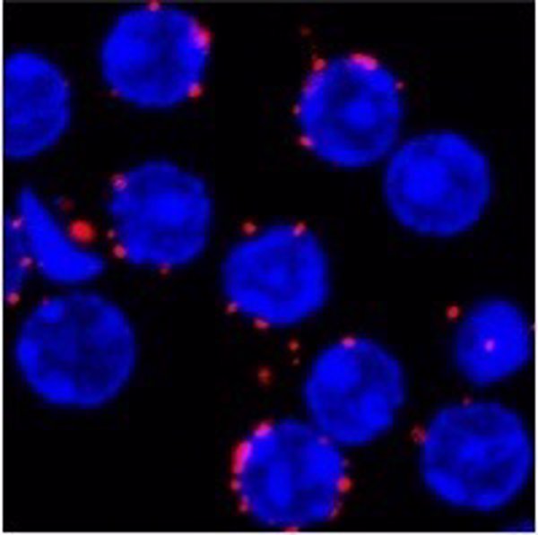 Expertos del CNIC identifican una proteína clave en un modelo de autoinmunidad causada por fallos del sistema inmune