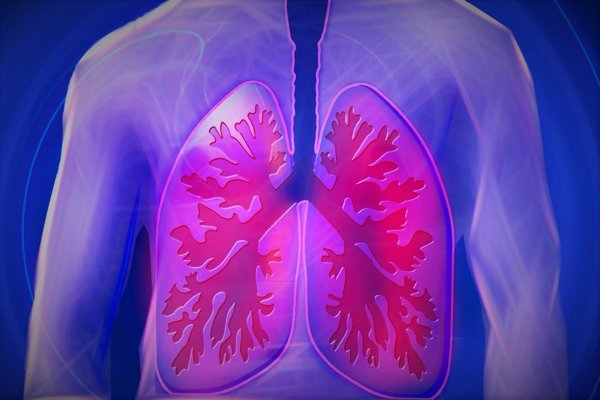 Pacientes denuncian que el diagnóstico de la fibrosis pulmonar idiopática puede tardar hasta 2 años