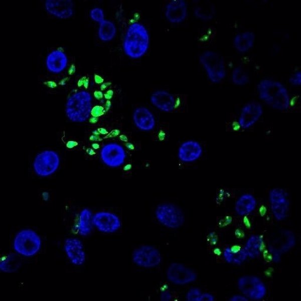 El parásito Leishmania se adapta a cambios ambientales amplificando cromosomas, según un estudio
