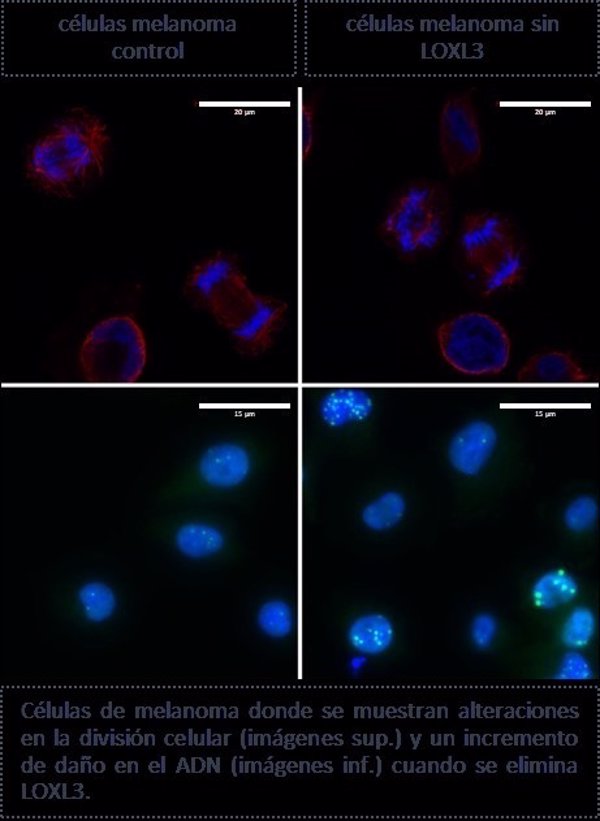 Las células del melanoma necesitan la proteína LOXL3 para sobrevivir