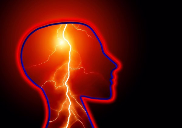 Expertos dicen que la cirugía de la epilepsia es la opción de los pacientes que no responden a la terapia con fármacos