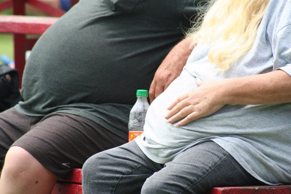 Vinculan la obesidad y el sobrepeso a problemas de salud a largo plazo tras una lesión cerebral traumática