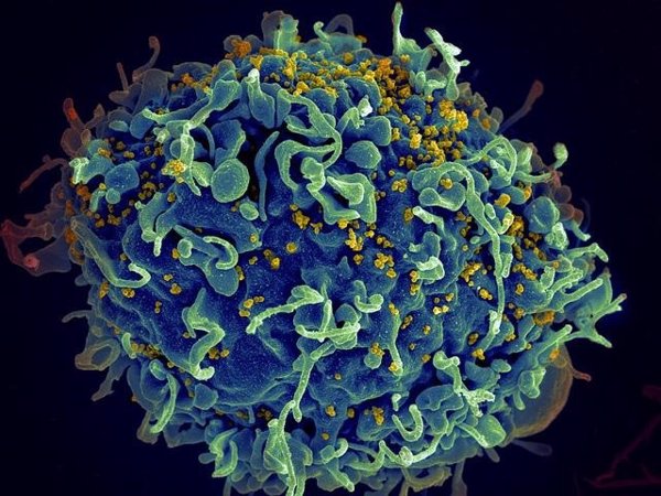 La nueva terapia de VIH minimiza el virus y aumenta la inmunidad en pacientes resistentes a medicamentos