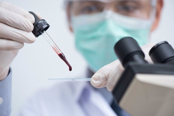 Un análisis del ADN liberado en sangre y semen permitirá determinar anomalías en los espermatozoides, según estudio