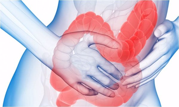 La mejoría del intestino irritable aumenta un 90% si se sigue el enfoque del síndrome de sensibilidad central