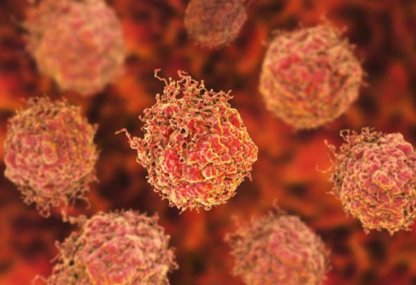 Definen el biomarcador en sangre que determina qué tratamientos aumentarán la supervivencia en cáncer de próstata