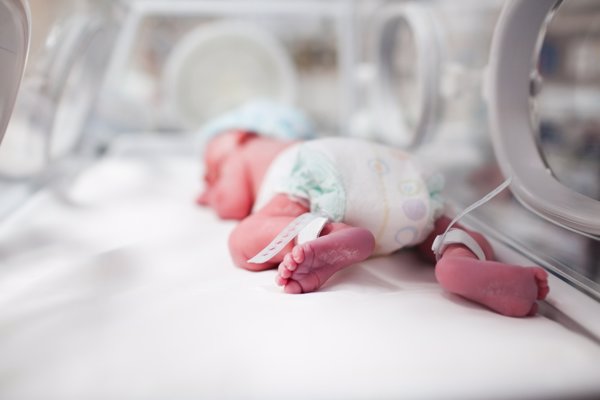 En España nacen 28.000 bebés prematuros al año, una de las tasas más altas de la Unión Europea
