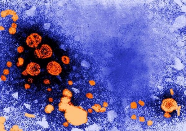 Un estudio muestra que muchos pacientes con cáncer padecen además hepatitis no diagnosticada anteriormente
