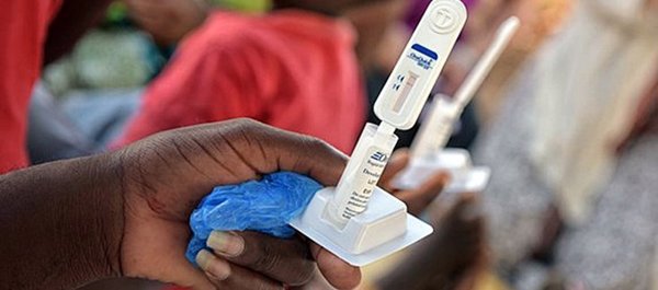 Un estudio alerta del aumento de los casos de contagio del subtipo B del VIH
