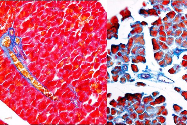 Investigadores de la UMA revelan un nuevo mecanismo molecular implicado en la reparación pancreática