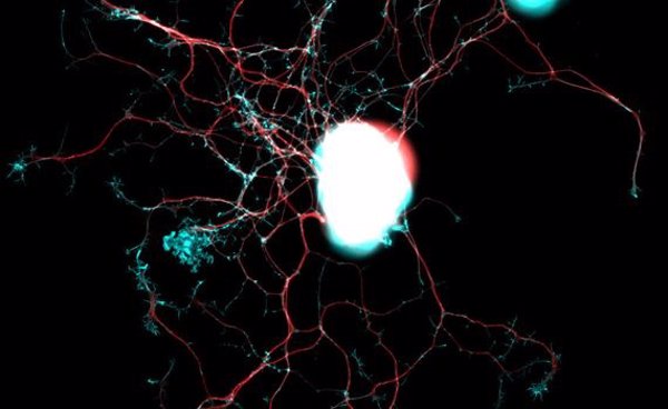 Investigadores identifican unas proteínas clave para la reparación de las fibras nerviosas