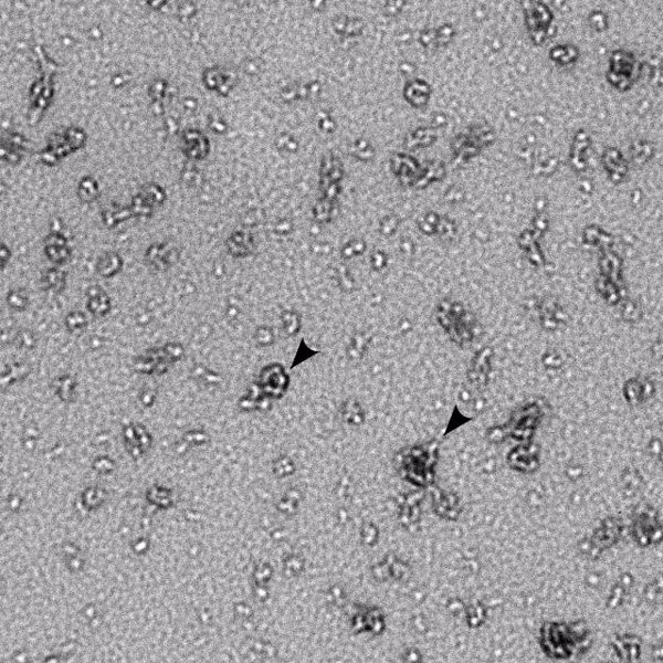 Investigadores identifican cómo el microbioma vaginal puede provocar resistencia a la clamidia
