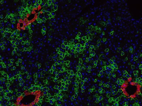 Investigadores desarrollan un fármaco que acelera la recuperación de las células madre tras la quimioterapia en ratones
