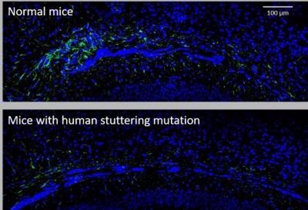 Un estudio en ratones identifica el tipo de célula cerebral involucrada en la tartamudez