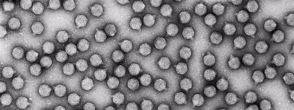 Descifran el mecanismo de actuación de un complejo clave en la infección del virus bacteriófago T7
