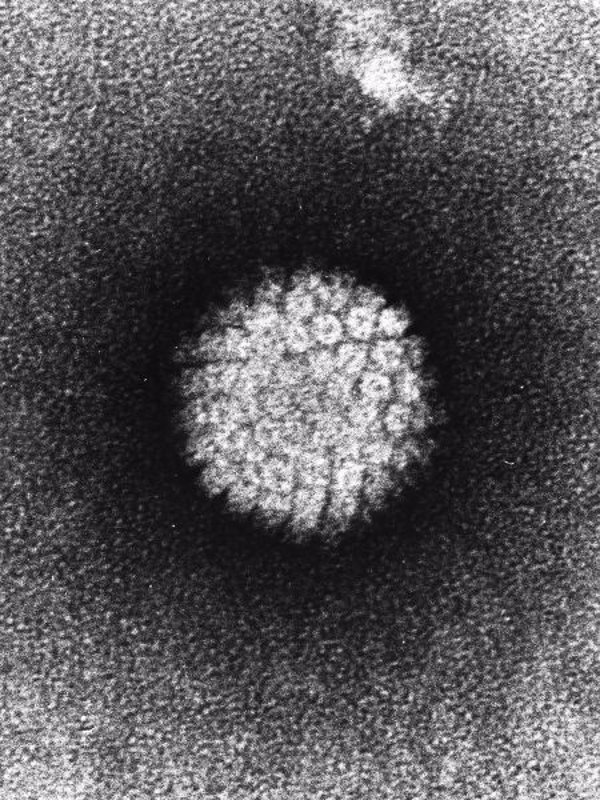 Un estudio sugiere que el virus del papiloma humano se podría contagiar a través de la sangre