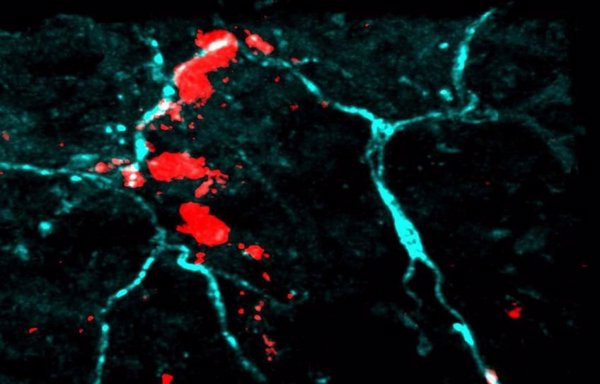 Investigadores demuestran cómo los alérgenos llegan hasta los nervios en la dermatitis atópica