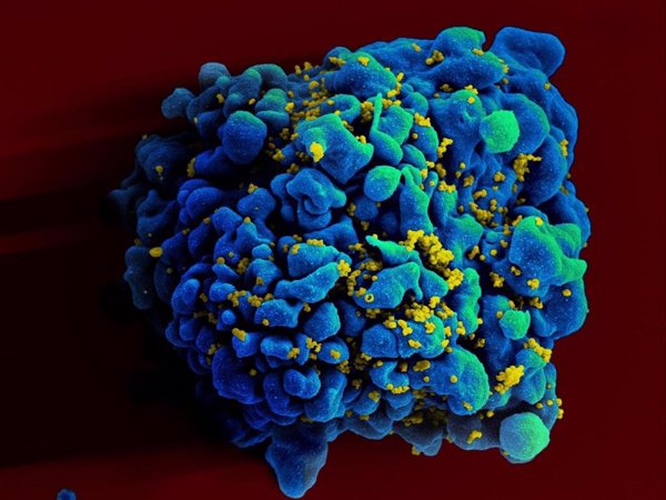 Científicos hipotetizan que los antirretrovirales podrían fomentar el crecimiento del reservorio del VIH