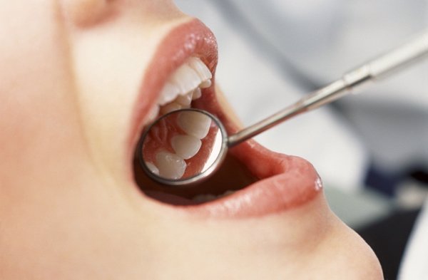 La estética dental copa más del 70% de las visitas al dentista