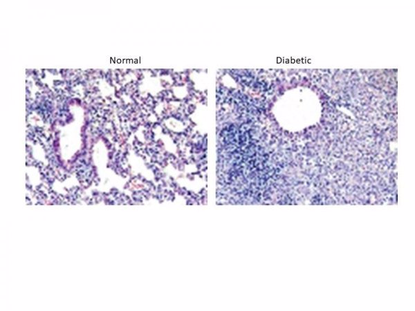 Investigadores explican en ratones por qué una infección respiratoria es más mortal en personas con diabetes