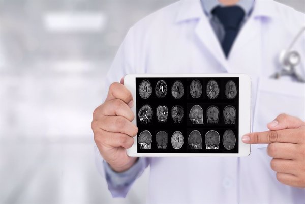 Investigadores españoles localizan biomarcadores cerebrales para detectar el Alzheimer