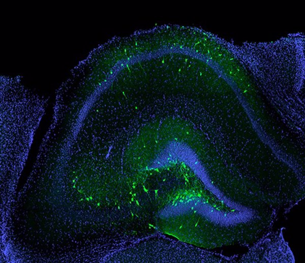 Una nueva terapia celular consigue mejorar la memoria y prevenir en convulsiones en ratones tras una lesión cerebral