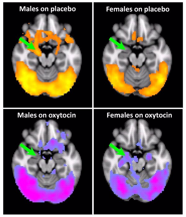 La oxitocina en mujeres adictas a la cocaína y con traumas infantiles incrementa el riesgo de recaída, según estudio