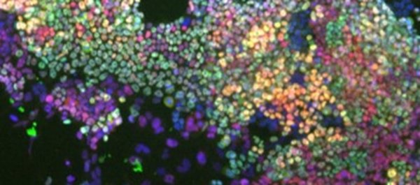 Investigadores españoles describen el papel del zinc para mantener la pluripotencia de las células madre embrionarias