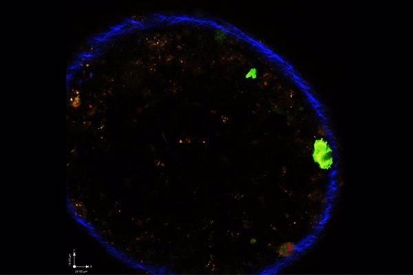 El parásito 'Toxoplasma gondii' no necesita infectar una célula inmune para alterar su comportamiento, según un estudio