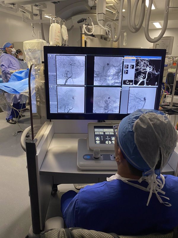 Cirujanos tratan por primera vez aneurismas cerebrales usando un brazo robótico
