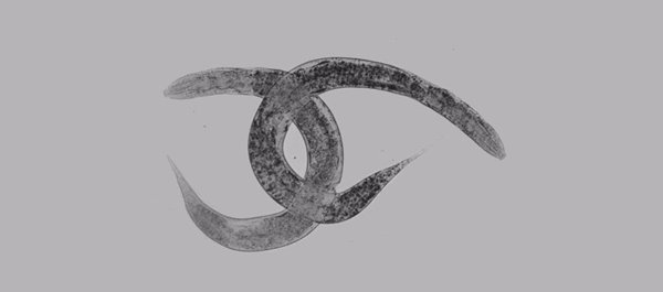 Investigadores españoles identifican en el gusano 'C. elegans' un nuevo modelo de la enfermedad rara X-ALD