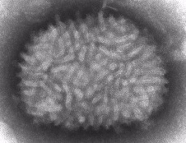 Científicos del CSIC trabajan en una vacuna para el Covid-19 a partir del virus que erradicó la viruela