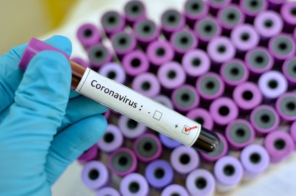 CSIF exige a Sanidad test masivos al personal sanitario para 