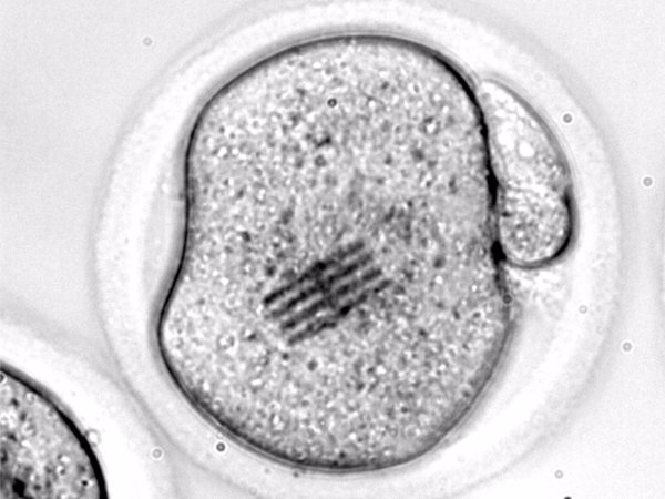 Científicos del CSIC fabrican chips que son inyectados en óvulos para medir las primeras fases del desarrollo