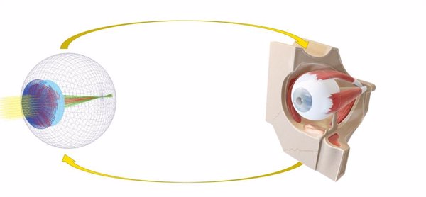 Miranza crea un 'software' que simula un ojo para saber la calidad visual de pacientes con defecto refractivo